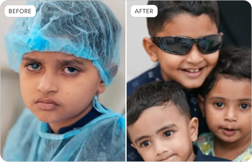 Albasar USA Keraniganj Eye Camp 2025 Before & After