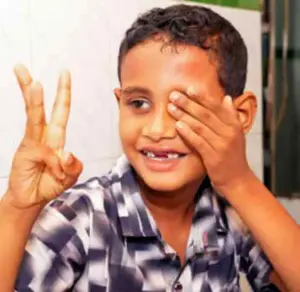 Hussein Ahmed after treatment